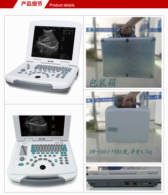 笔记本b超机,黑白便携式B超,b超机器多少钱一台