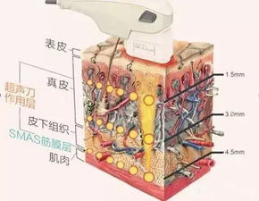 你问我答 揭开 美容超声刀 的神秘面纱