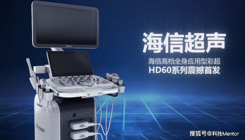 九年追梦终成真,海信超声hd60卓越登场,国产超声未来可期